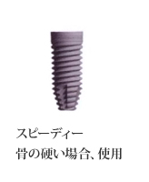 インプラントとは