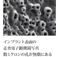 予知性の高い審美性