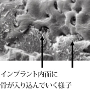 予知性の高い審美性