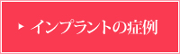 インプラント症例