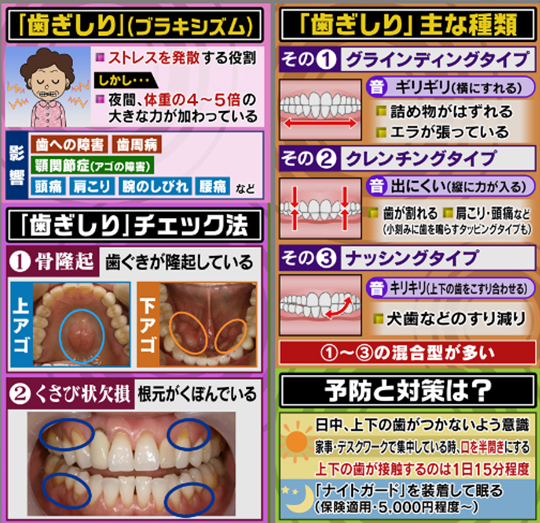 大阪読売TV・ミヤネ屋にて当医院が放映